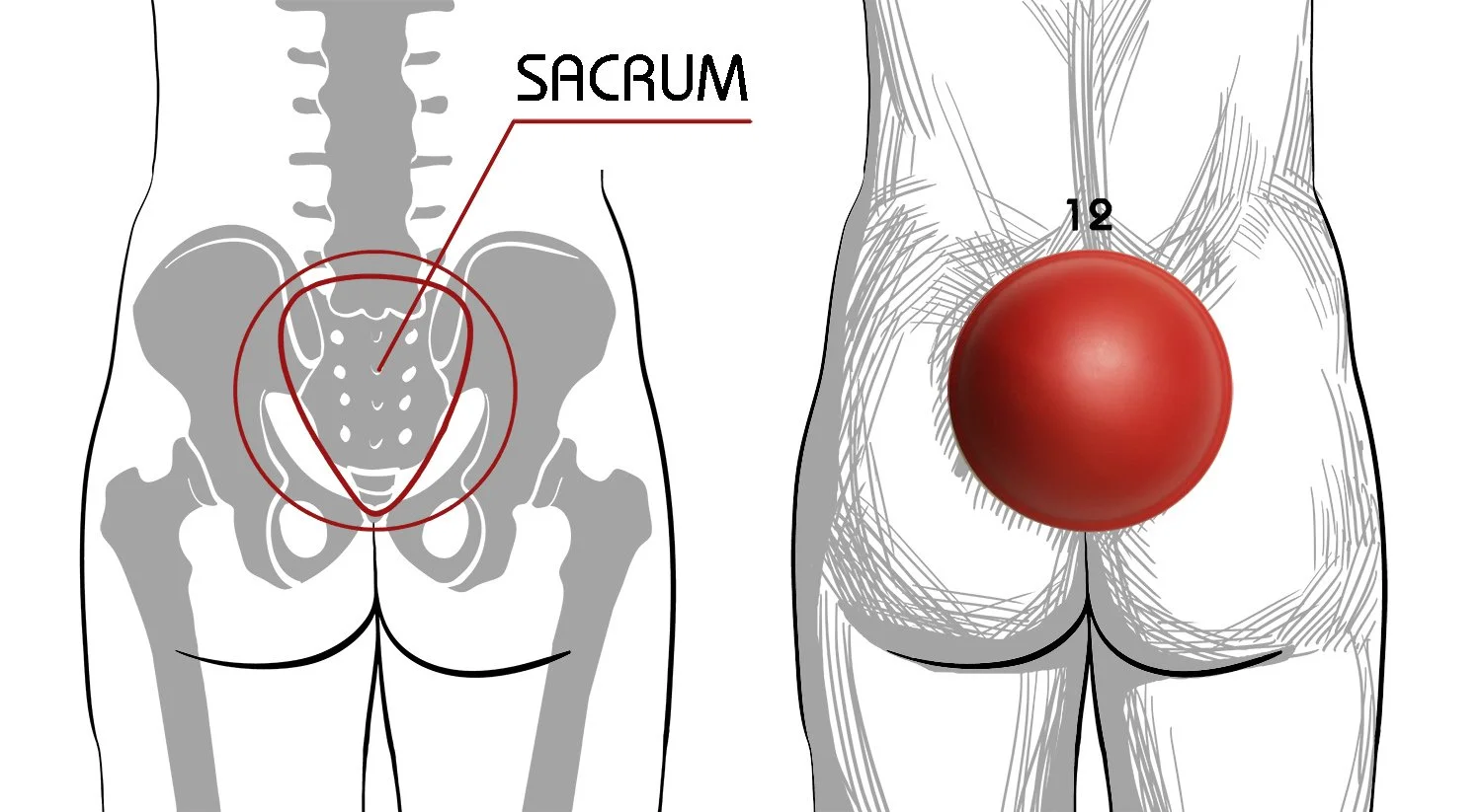 SPAT : Soutaihou-based Pelvic Adjustmen… Pelvic Analysis and Adjustment by Dr. Rahim Gonstead Chiropractor